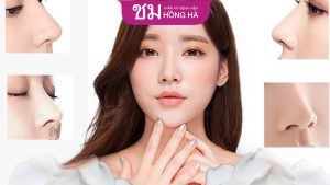 Nâng mũi cấu trúc khác gì nâng mũi thường? Nên chọn loại nào?