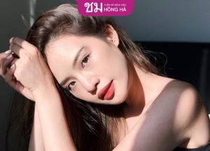 Đi tìm câu trả lời cho “nâng mũi có để được cả đời không?”