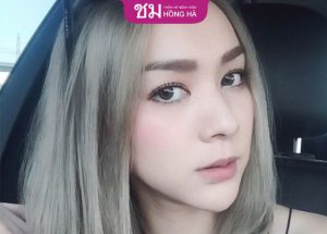 Nâng mũi được bao lâu? 3 Yếu tố ảnh hưởng đến thời gian