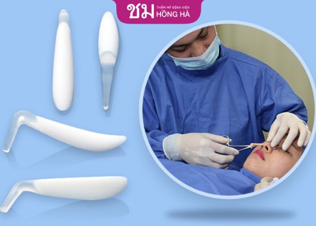 Lựa chọn đúng chất liệu sụn