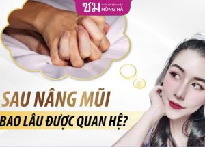 Nâng mũi xong bao lâu được quan hệ – Bác sĩ trả lời