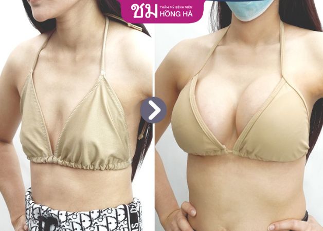 Tự tin với vòng 1 tròn đẹp tự nhiên