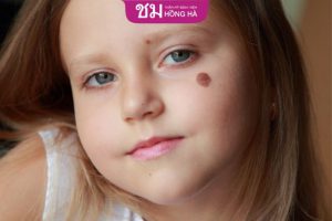 Vận mệnh của nốt ruồi ở lông mày “TỐT” hay “XẤU”