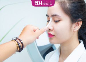 8 phương pháp phẫu thuật nâng mũi hiện đại giúp lột xác hoàn hảo