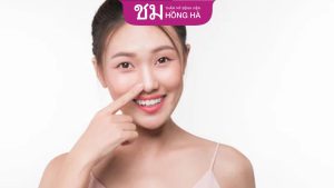 Phẫu thuật nắn chỉnh xương chính mũi – Giải pháp hiệu quả