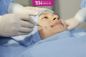 Tạo má lúm đồng tiền có vĩnh viễn không – Chuyên gia giải đáp