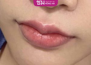 Tạo môi chẻ đẹp hay xấu? Cách làm môi trẻ sexy, quyến rũ