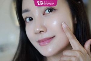 Bí kíp điều trị sẹo thâm sau mụn đúng cách, an toàn nhất