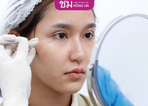 Bật mí 4 cách chăm sóc sau khi bấm mí lành đẹp thần tốc