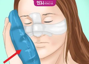 5 Tip chăm sóc nâng mũi sát Tết – Những lưu ý bạn nên biết