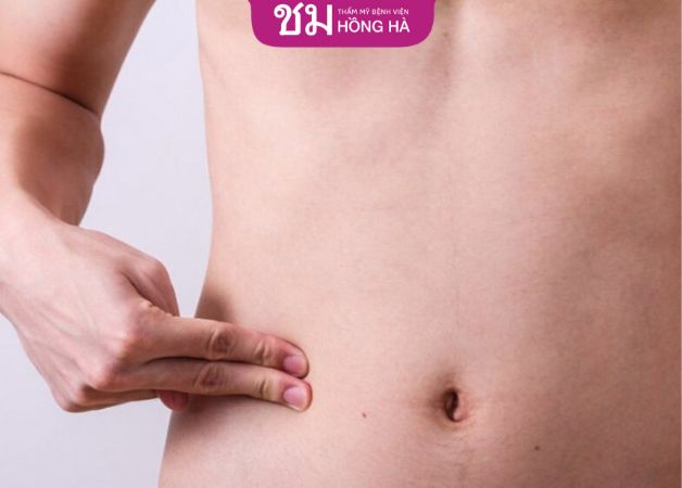 Quan tâm đến việc vệ sinh vết mổ ở bụng