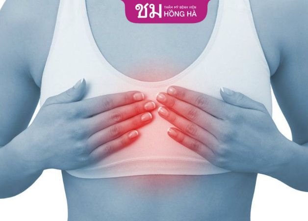 Co thắt bao xơ xảy ra sau thẩm mỹ nâng ngực, mũi