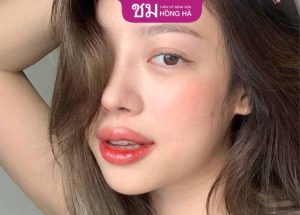 Nâng mũi Thai Shape kịp đón tết không – Review từ khách hàng