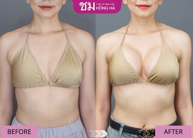 Khách hàng sở hữu đôi gò bồng đào căng tròn, mềm mại chuẩn gái Thái