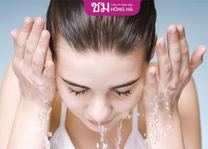 Nhấn mí kiêng nước bao lâu – bác sĩ Robert Nguyễn giải đáp