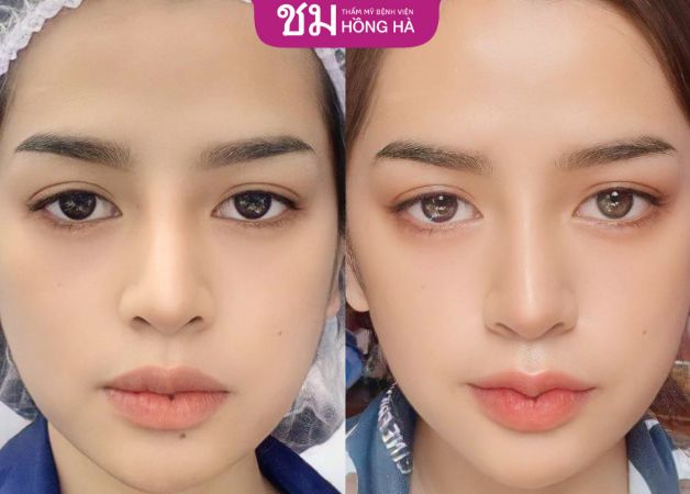 Đôi môi trái tim đẹp chuẩn Thái
