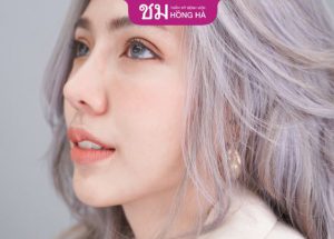 Cập nhật bảng giá nâng mũi cấu trúc mới nhất