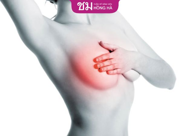 Co thắt bao xơ khi nâng ngực