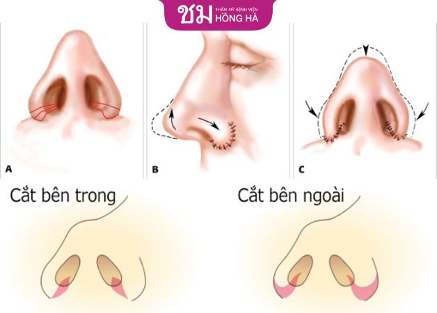Kỹ thuật cắt cánh mũi quyết định đến giá
