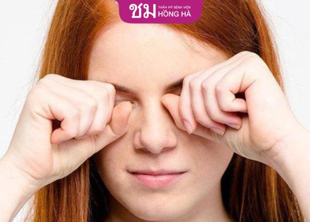 Cắt chỉ bao lâu thì cắt chỉ - Không nên dụi, gãi mắt khiến kéo dài thời gian hồi phục