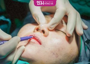 Cắt môi trái tim có đau không? – Bác sĩ Daniel Nguyễn giải đáp