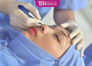 Chỉnh hình sụp mí bẩm sinh có nguy hiểm không – Giải đáp bác sĩ
