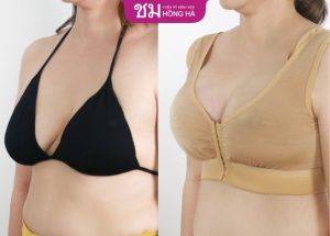 Feedback nâng ngực cực mê, cực chất tại Hồng Hà