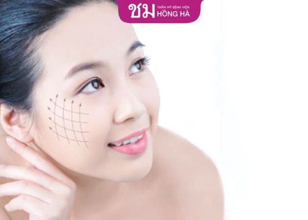 Sau 1-2 tháng gương mặt hết sưng, lành tự nhiên