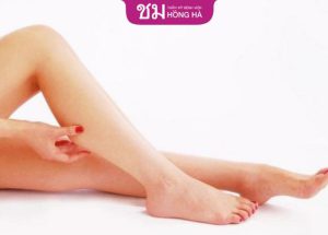 Hút mỡ bắp chân – Giải pháp sở hữu đôi chân thon thả, ngọc ngà