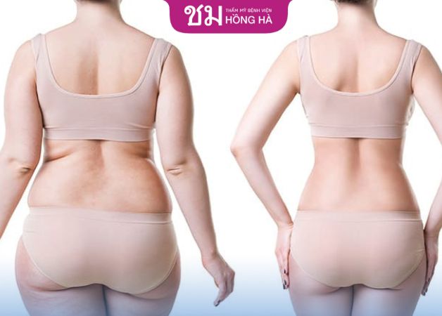 Vai mảnh mai, thon gọn và mềm mại hơn