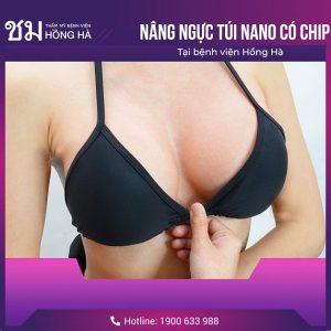 Kinh nghiệm chọn size nâng ngực – Sở hữu vòng 1 quyến rũ