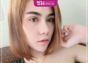 Giải đáp: Nâng mũi cấu trúc có bị tụt sụn không