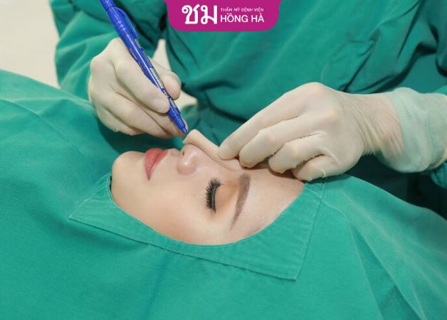 Nâng mũi cấu trúc sụn tai giá bao nhiêu phụ thuộc vào tay nghề bác sĩ