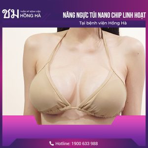 Nâng ngực mất bao nhiêu thời gian- Bác sĩ Robert Nguyễn giải đáp