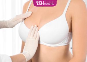 Nâng ngực sau bao lâu thì mềm – Bác sĩ Robert Nguyễn giải đáp