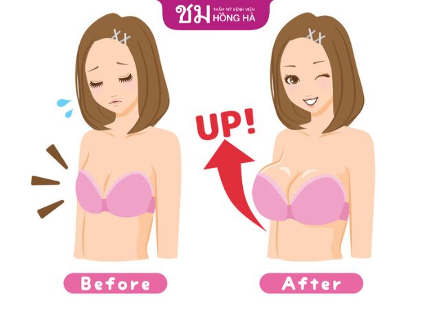 Nâng ngực sẽ không ảnh hưởng đến sức khỏe nếu chọn địa chỉ thẩm mỹ uy tín