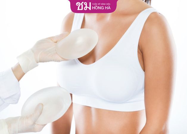 Nên chọn túi ngực chất lượng