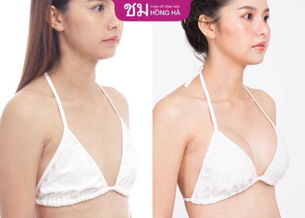 Khách hàng sở hữu vòng 1 quyến rũ với khe ngực sexy