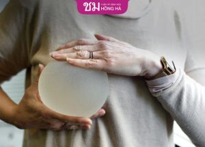 Chuyên gia giải đáp: Nên nâng ngực trước hay sau sinh?