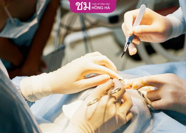 Địa chỉ thực hiện ảnh hưởng đến giá thẩm mỹ mắt bao nhiêu