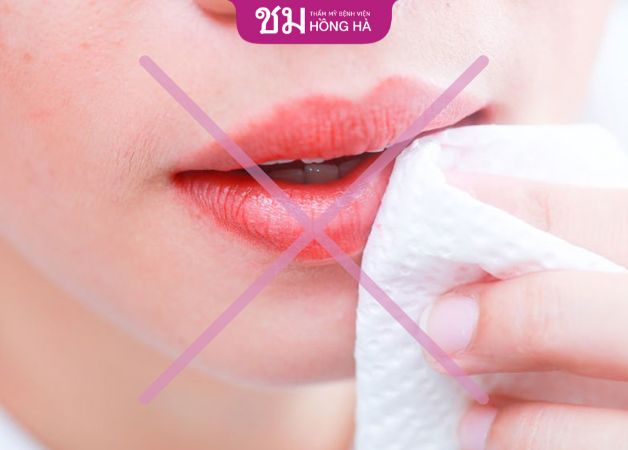 Tránh tác động mạnh lên vùng môi