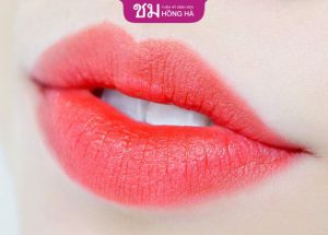 Thu mỏng môi có được vĩnh viễn không? – Cách chăm sóc môi