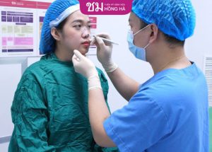 Chuyên gia giải đáp: Thu nhỏ cánh mũi có đau không?