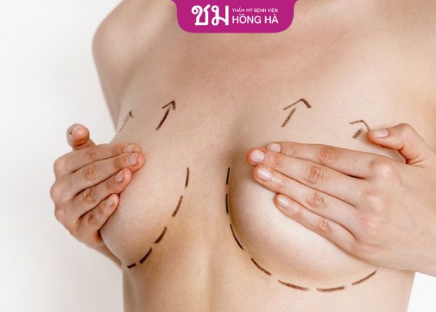 Đảm bảo sức khỏe tốt trước phẫu thuật