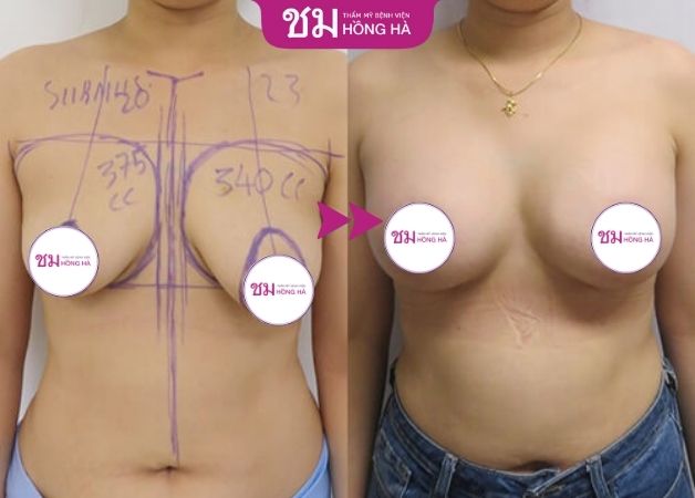 Khắc phục thành công từ mướp thành bưởi