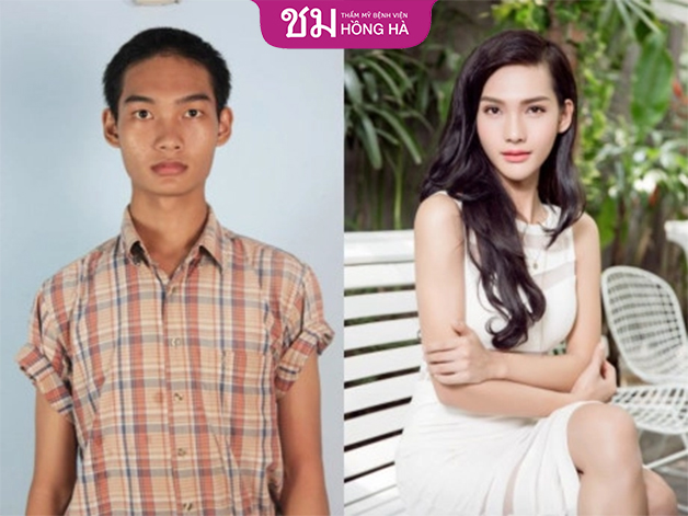 Công nhận phẫu thuật chuyển giới gây nên nhiều hệ lụy về pháp luật