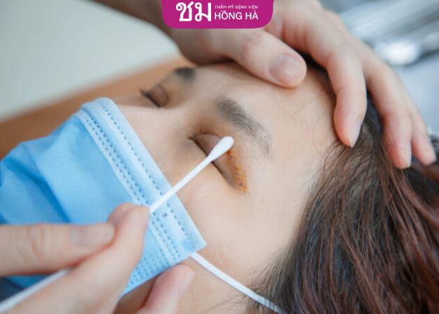 Cách chăm sóc mắt sau khi cắt mí