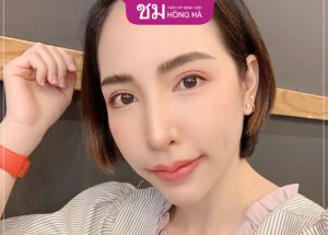 Cách chăm sóc môi sau khi cắt môi trái tim đẹp, nhanh lành