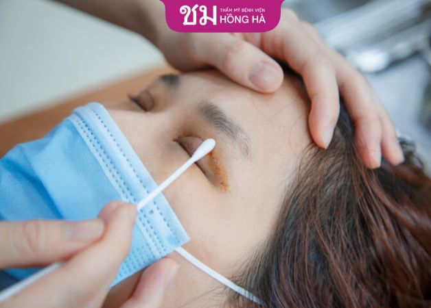Cách chăm sóc môi sau khi cắt môi trái tim: Vệ sinh theo đúng chỉ dẫn từ bác sĩ