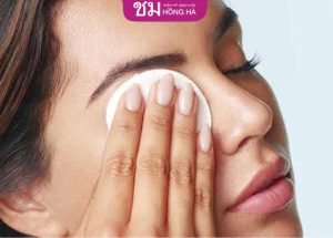 Cách chăm sóc sau khi lấy mỡ bọng mắt mau lành